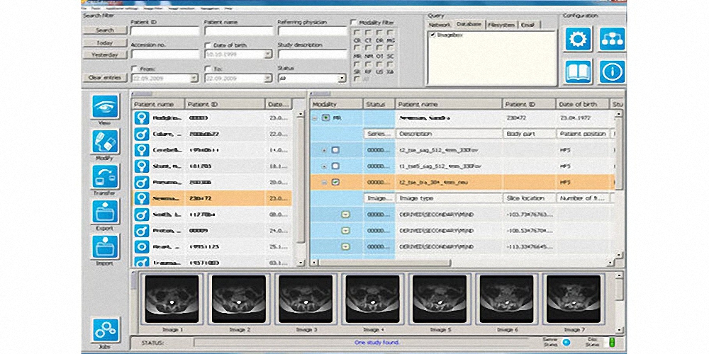 kostengünstiges und einfach zu bedienendes PACS